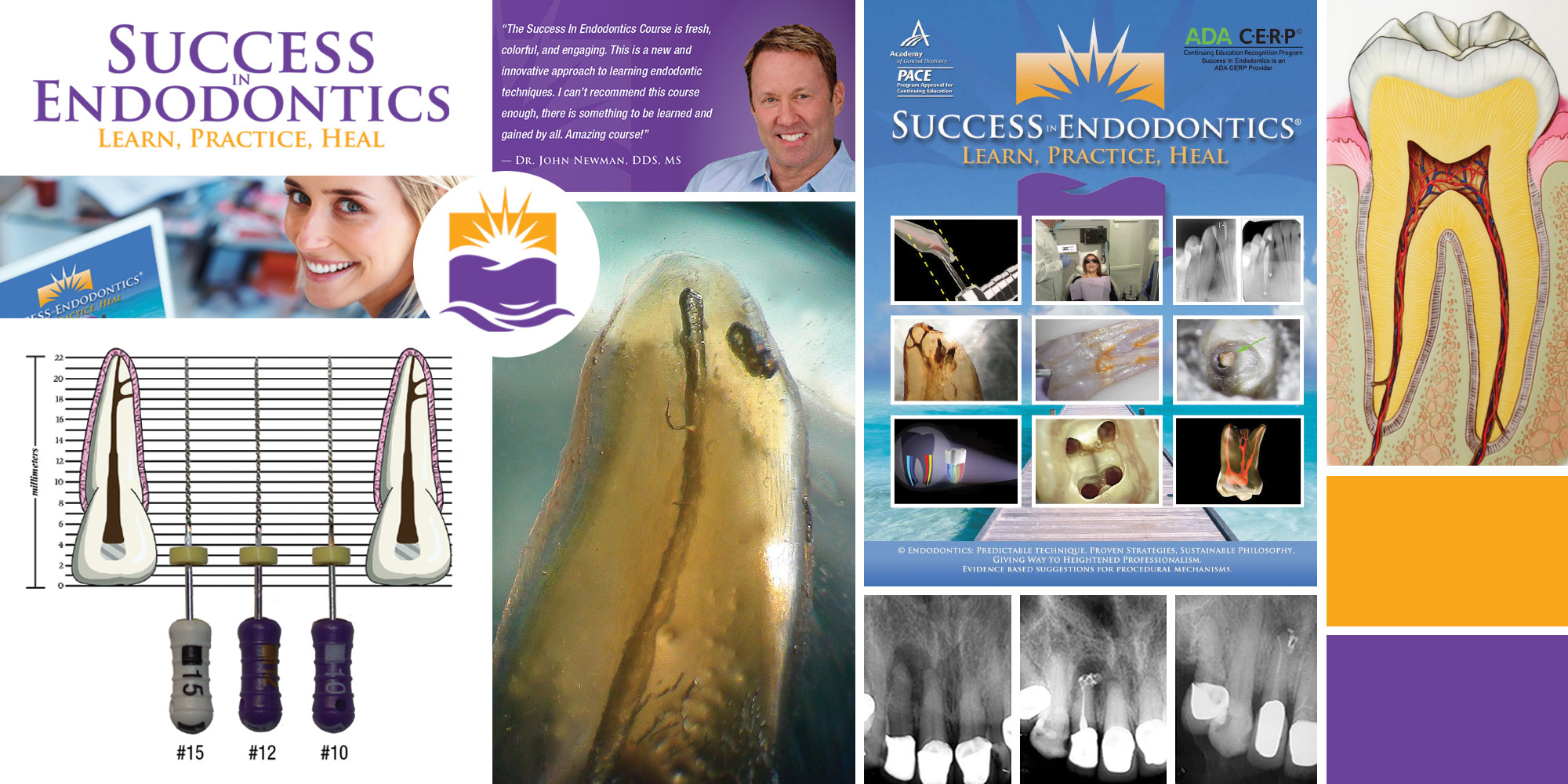 Succes In Endodontics project collage